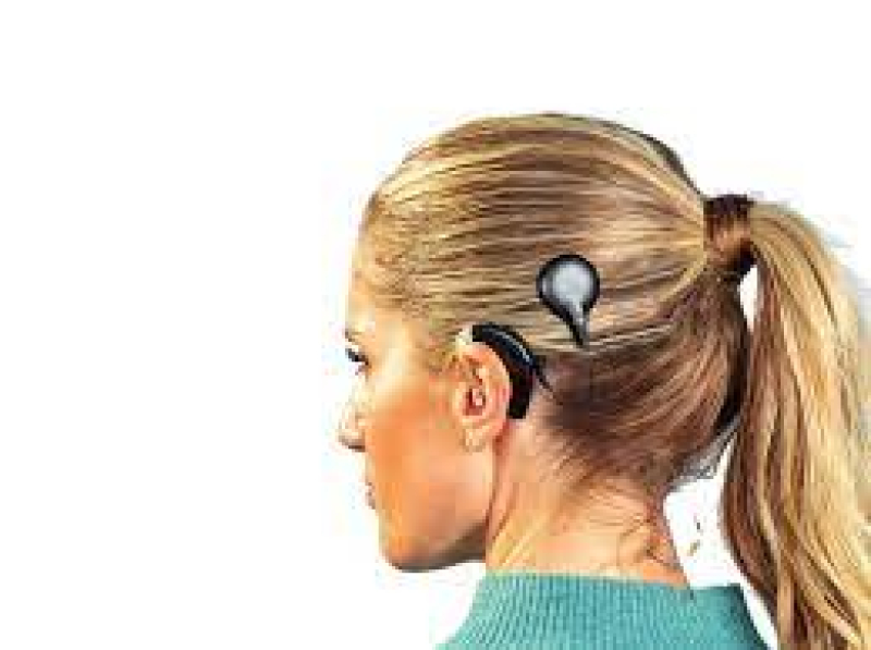 Advanced Bionics Slim Überträger Kabel AquaMic 61 cm